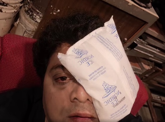 Atul Todankkar actor eye infection